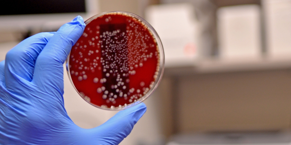 Микробиологические испытания и нормы для оценки эффективности очистки